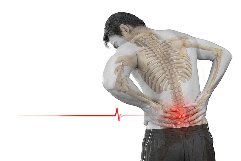 Почему болит спина после прогибов и как себя обезопасить?